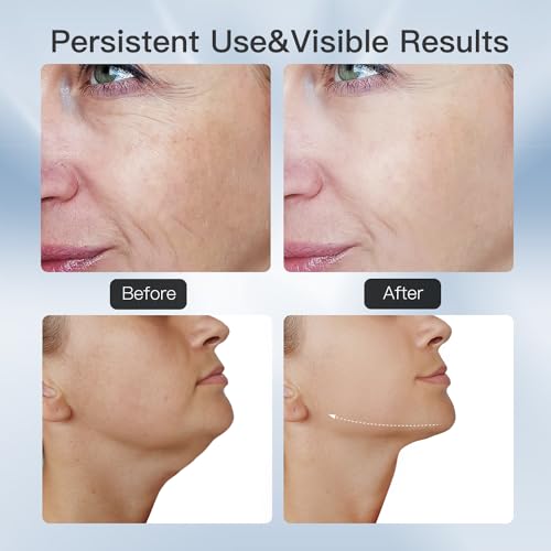 Enarit 3-in-1 LED Thermal Neck and Face Massager